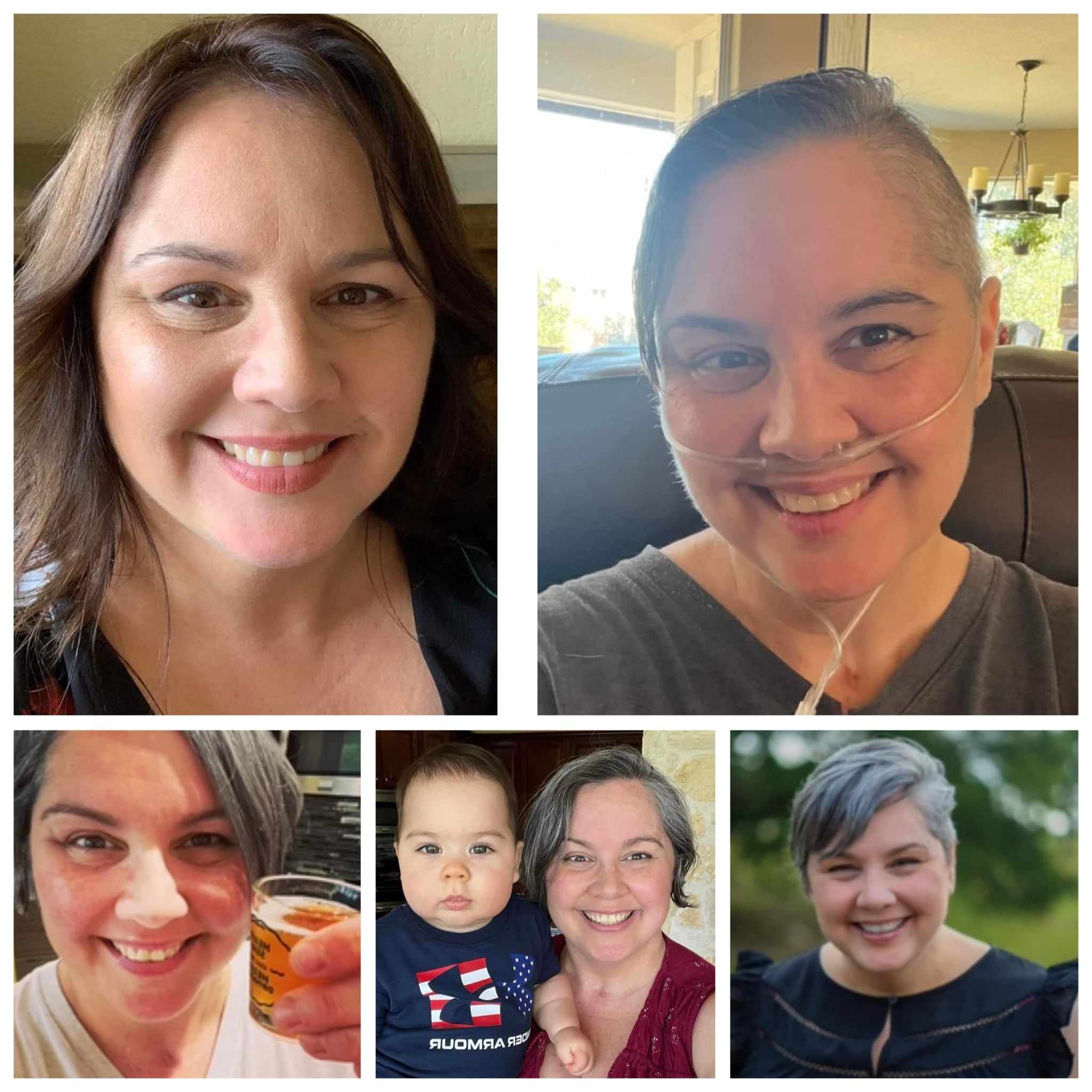 before and after photos from using Glow