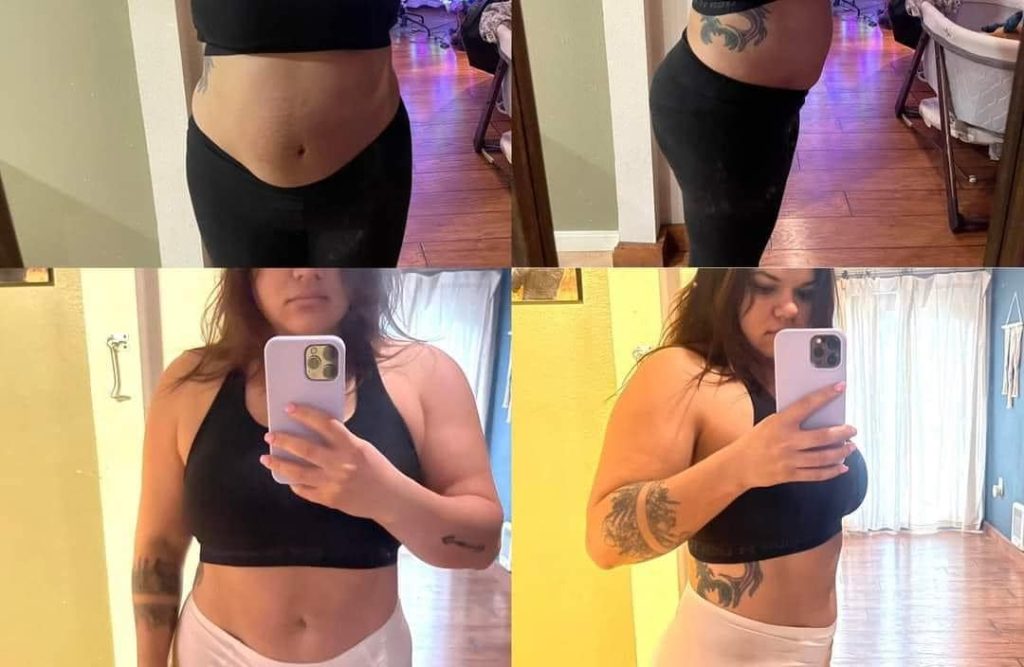 before and after using tranont products