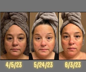 before and after photo of Glow and Enrich