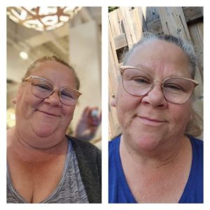 before and after using Glow collagen
