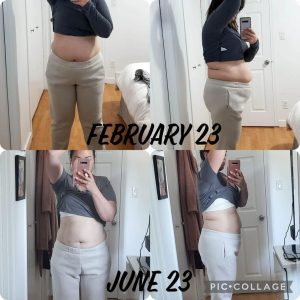 before and after photos using Tranont products