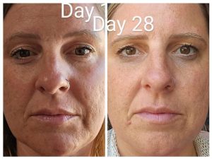 A women's face 28 day results after using Glow