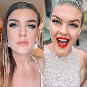 Before and after photo of women after post partum and taking Tranont products