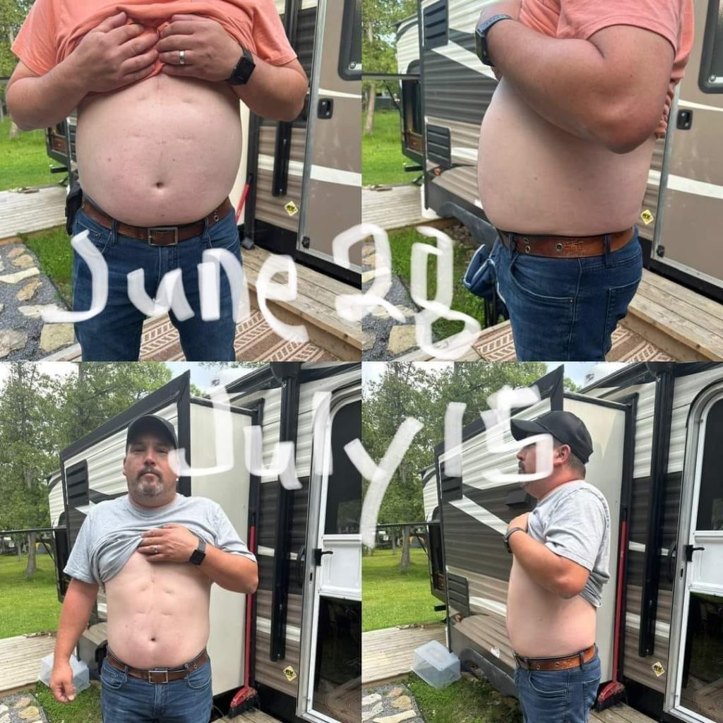 before and after bloating going down after using Enrich
