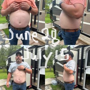 before and after bloating going down after using Enrich