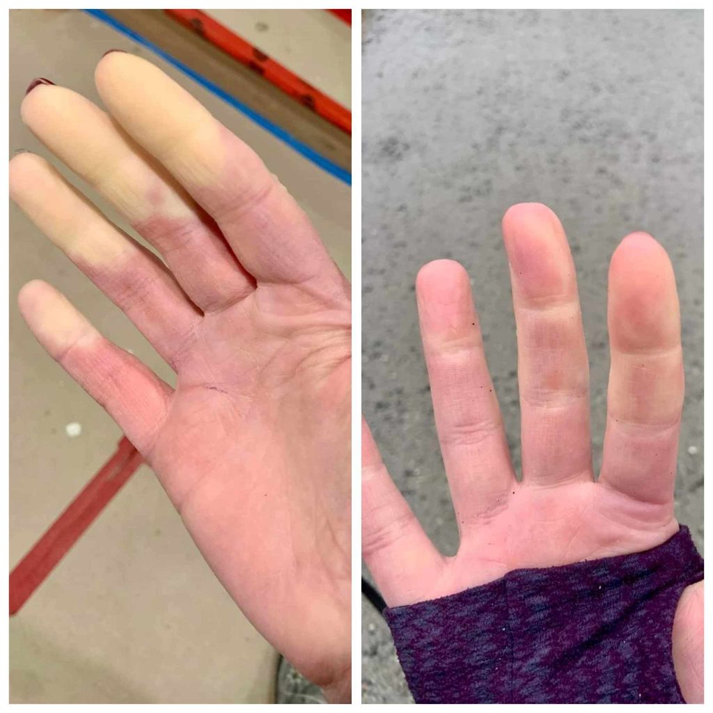 before and after photo of hands after using Optimize
