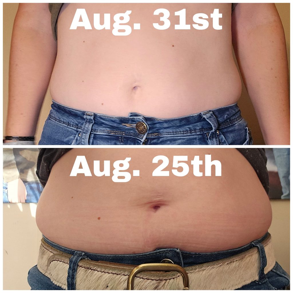 before and after photo of weightloss after using Tranont products