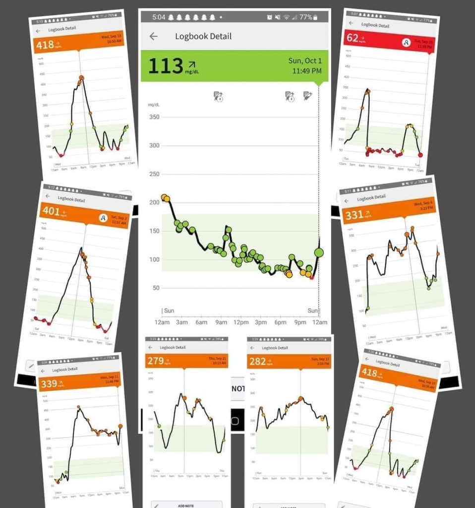 pictures of blood sugar before and after Transform