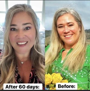 before and after photo of weight loss due to Transfrom