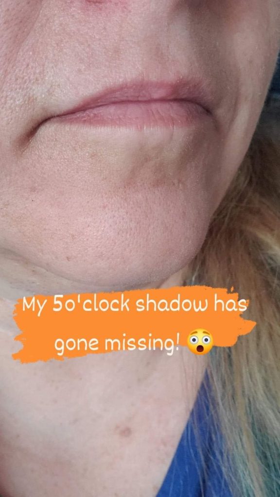 a close up of a women's chin