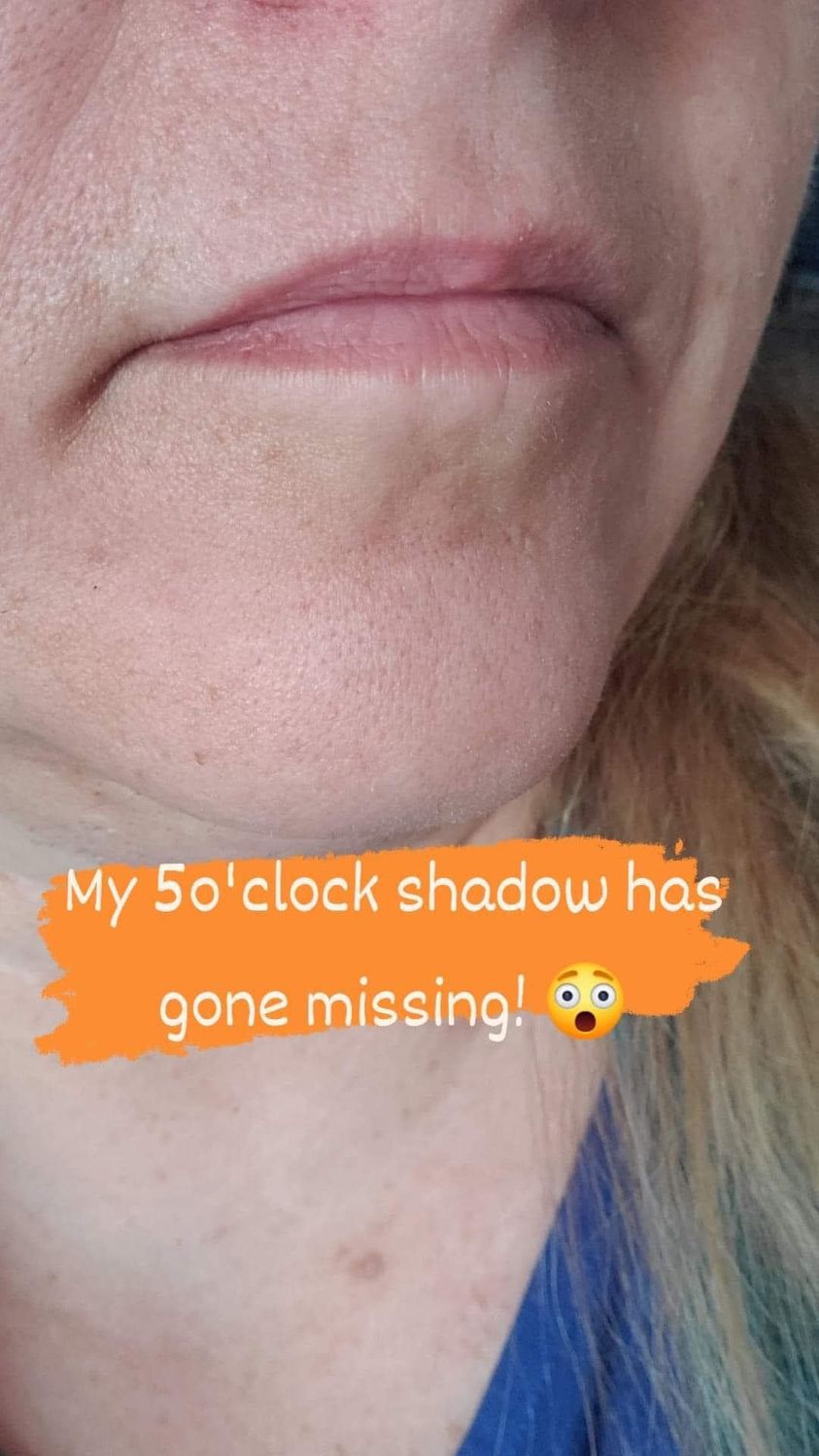 a close up of a women's chin