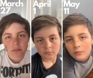before and after photos of little boy using Enrich