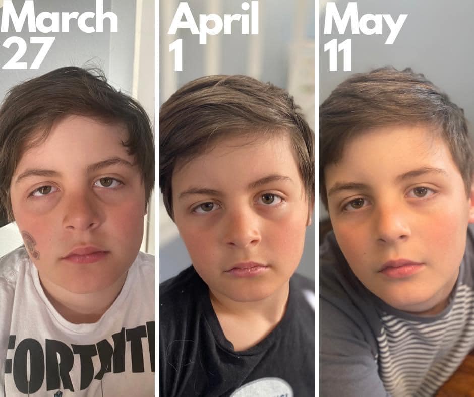 before and after photos of little boy using Enrich