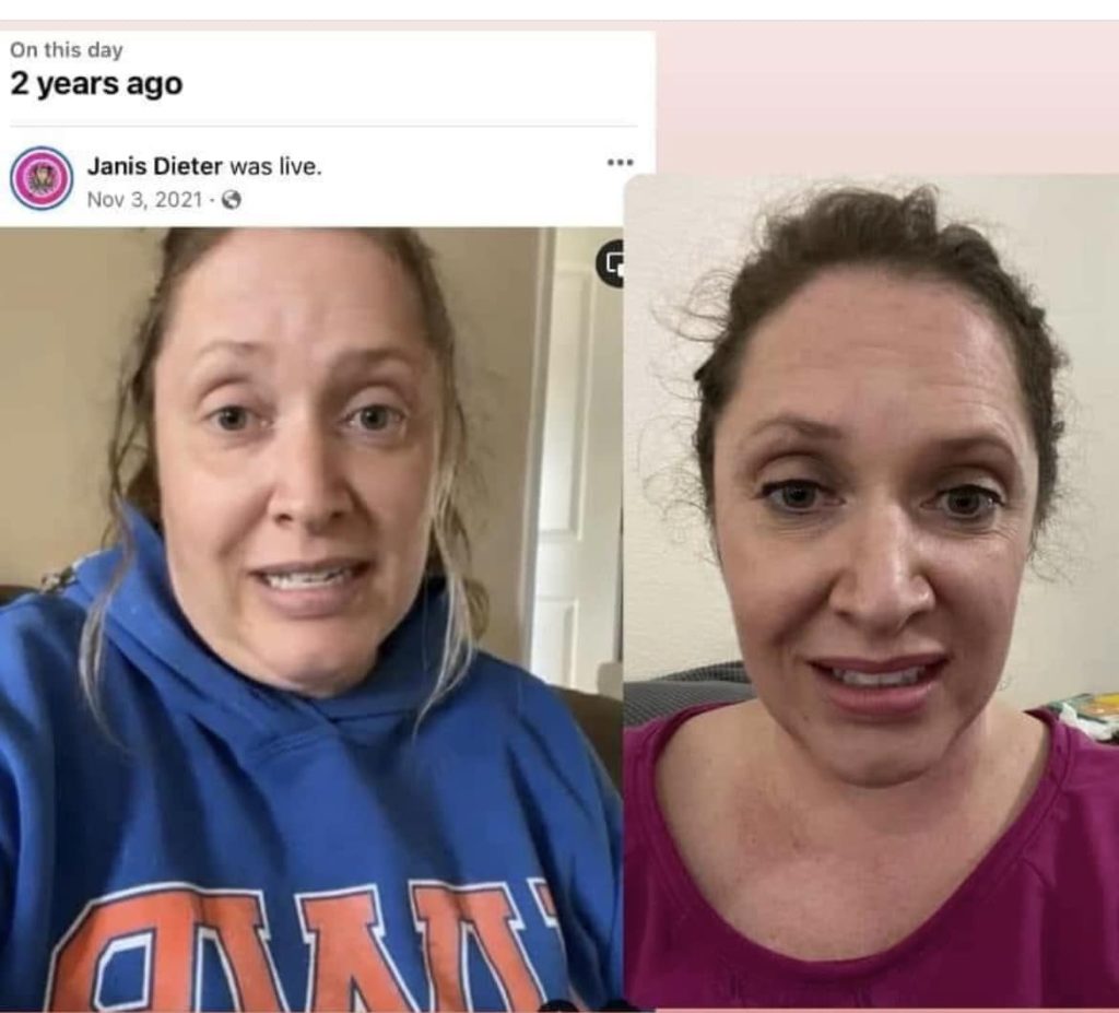 before and after photos after taking transform