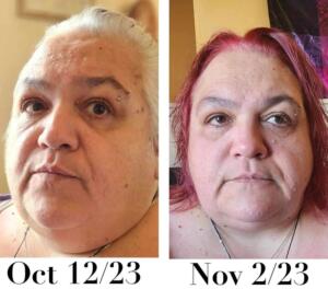 before and after weight loss photos of woman after taking Transform