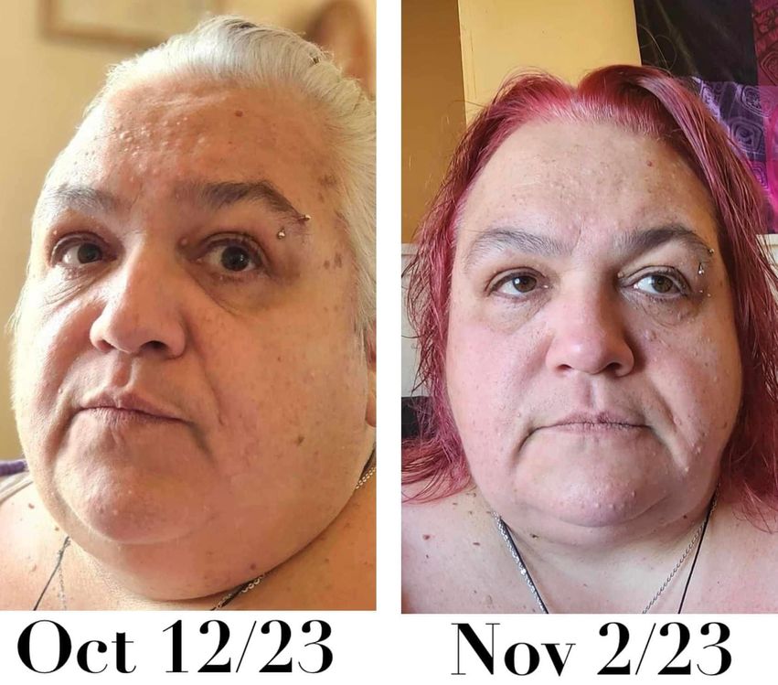 before and after weight loss photos of woman after taking Transform