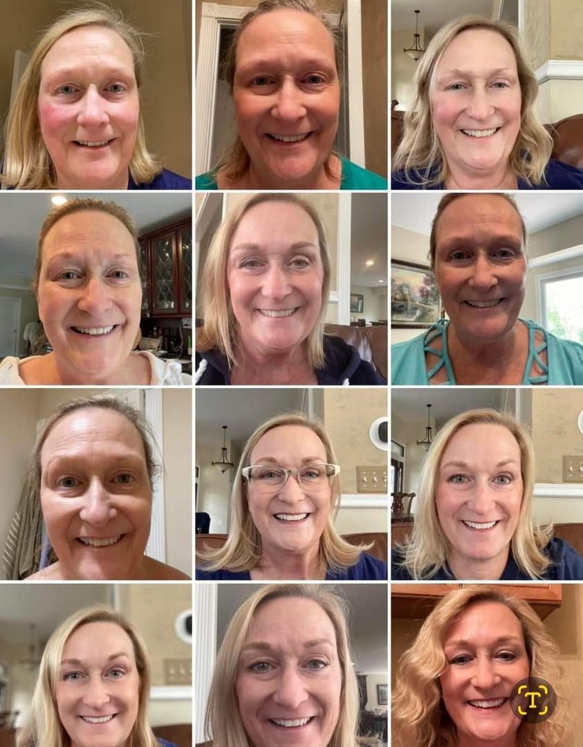 a bunch of before and afters of her face improving due to Glow collagen