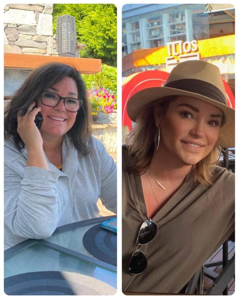 Before and after photo of woman losing weight